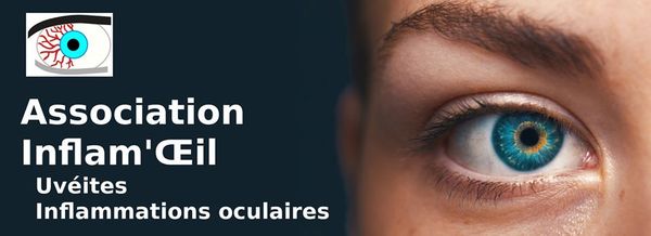 facebook.com/inflamoeil